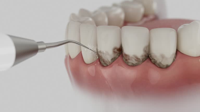 Reliable Teeth Cleaning And Checkup contractor in Clay County County, SD by Dentist Open Now